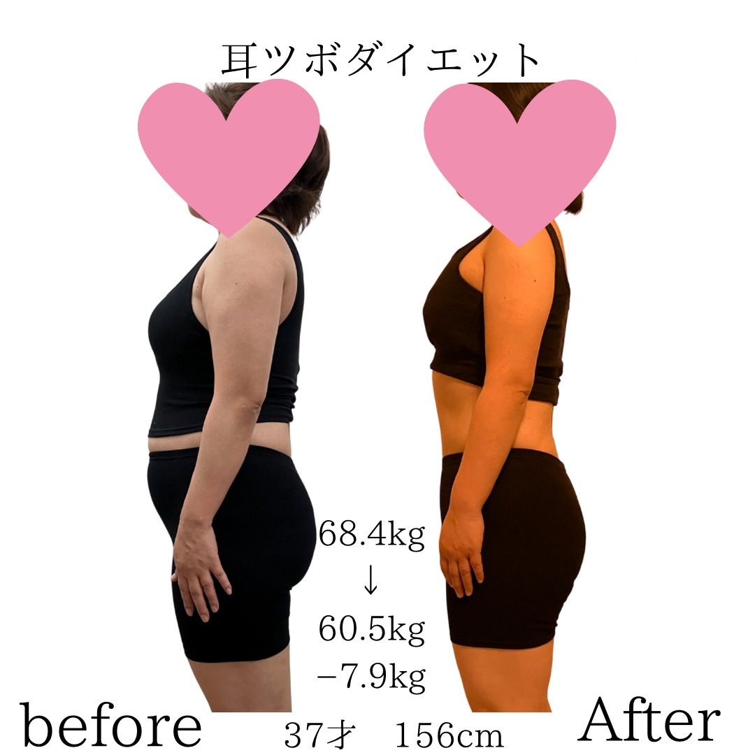 お客様の施術結果2